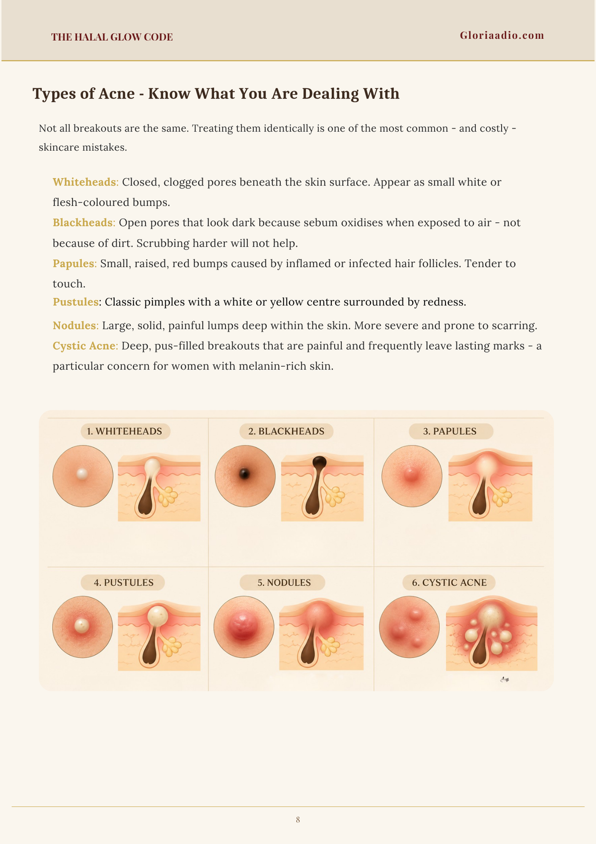 The Halal Glow Code acne types guide showing whiteheads, blackheads, papules, pustules, nodules and cystic acne