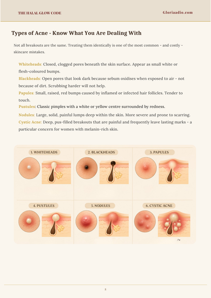 The Halal Glow Code acne types guide showing whiteheads, blackheads, papules, pustules, nodules and cystic acne